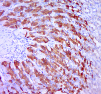 KLC3 Rabbit Polyclonal Antibody