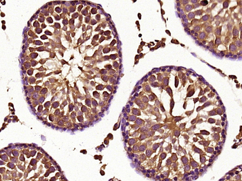KLHL18 Rabbit Polyclonal Antibody