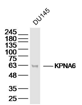 KPNA6 Rabbit Polyclonal Antibody
