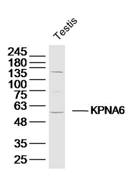 KPNA6 Rabbit Polyclonal Antibody