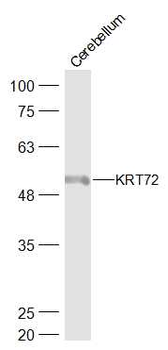 KRT72 Rabbit Polyclonal Antibody