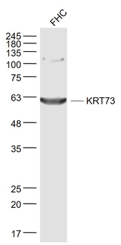 KRT73 Rabbit Polyclonal Antibody