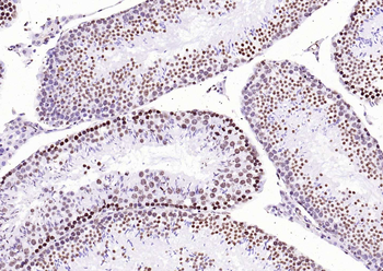 Histone H3 (Tri Methyl K4) Rabbit Polyclonal Antibody