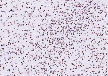 Histone H3 (Tri Methyl K4) Rabbit Polyclonal Antibody