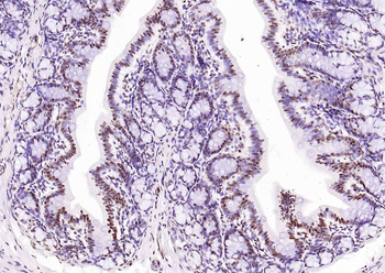 Histone H3 (Tri Methyl K4) Rabbit Polyclonal Antibody