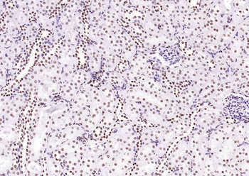 Histone H3 (Tri Methyl K4) Rabbit Polyclonal Antibody