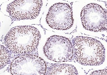 Histone H3 (Tri Methyl K4) Rabbit Polyclonal Antibody