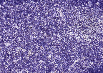 Histone H3 (Tri Methyl K4) Rabbit Polyclonal Antibody