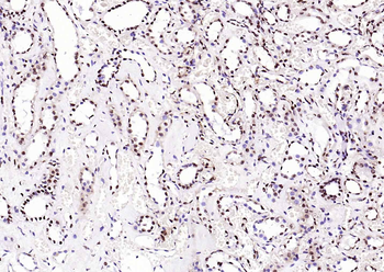 Histone H3 (Tri Methyl K4) Rabbit Polyclonal Antibody
