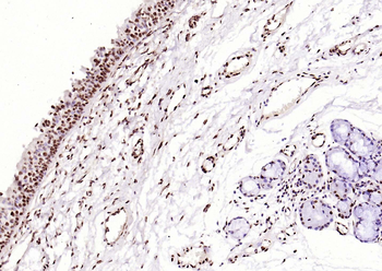 Histone H3 (Tri Methyl K4) Rabbit Polyclonal Antibody