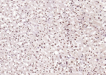 Histone H3 (Tri Methyl K4) Rabbit Polyclonal Antibody