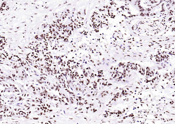 Histone H3 (Tri Methyl K4) Rabbit Polyclonal Antibody