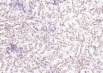 Histone H3 (Tri Methyl K4) Rabbit Polyclonal Antibody