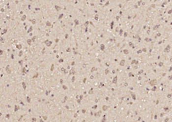 KCNK1 Rabbit Polyclonal Antibody