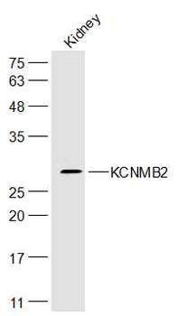 KCNMB2 Rabbit Polyclonal Antibody