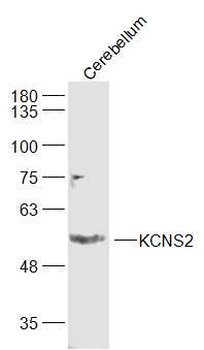 KCNS2 Rabbit Polyclonal Antibody