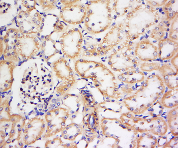 KCNV1 Rabbit Polyclonal Antibody