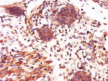 KCT2 Rabbit Polyclonal Antibody