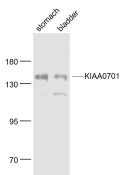 KIAA0701 Rabbit Polyclonal Antibody