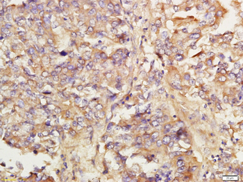 KIAA0701 Rabbit Polyclonal Antibody