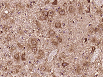KIAA1107 Rabbit Polyclonal Antibody