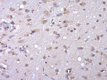 KIAA1107 Rabbit Polyclonal Antibody