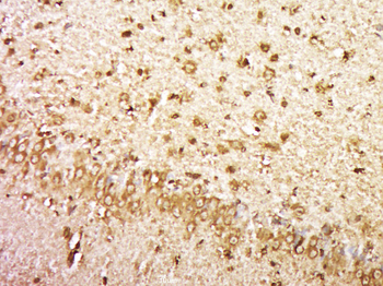 KIAA1161 Rabbit Polyclonal Antibody