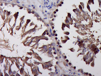 KIAA1370 Rabbit Polyclonal Antibody