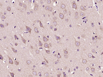 KIAA1434 Rabbit Polyclonal Antibody