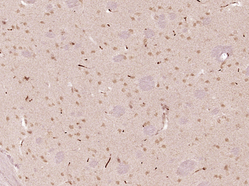 KIAA1755 Rabbit Polyclonal Antibody