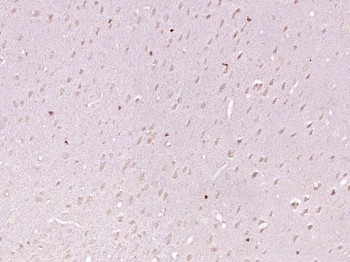KIAA1755 Rabbit Polyclonal Antibody