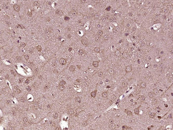 KIF13A Rabbit Polyclonal Antibody