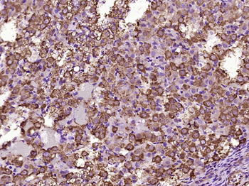 KIF13A Rabbit Polyclonal Antibody