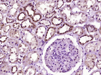 KIF6 Rabbit Polyclonal Antibody