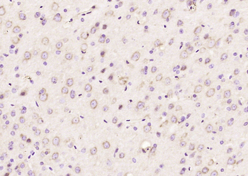 Kindlin Rabbit Polyclonal Antibody