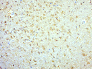 Kinesin 5C/NKHC2 Rabbit Polyclonal Antibody