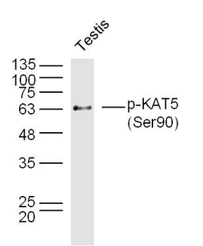 Phospho-KAT5 (Ser90) Rabbit Polyclonal Antibody