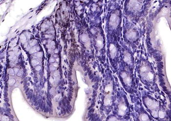 Phospho-TRIM28 (Ser473) Rabbit Polyclonal Antibody