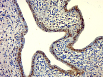 L3MBTL2 Rabbit Polyclonal Antibody