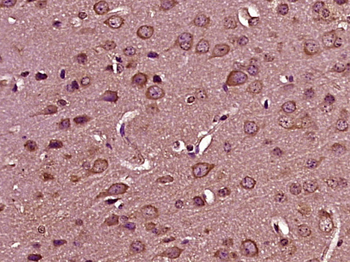 LARP4B/LARP5 Rabbit Polyclonal Antibody
