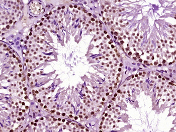LARP7 Rabbit Polyclonal Antibody