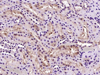 LULL1/TOR1AIP2 Rabbit Polyclonal Antibody