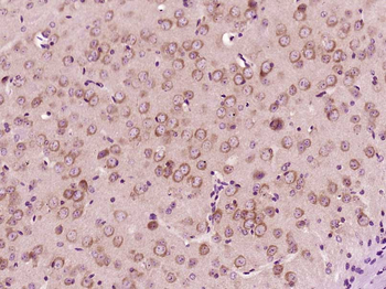 LCHN Rabbit Polyclonal Antibody