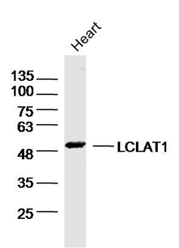 LCLAT1 Rabbit Polyclonal Antibody