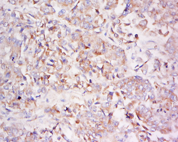 LDLRAD3 Rabbit Polyclonal Antibody