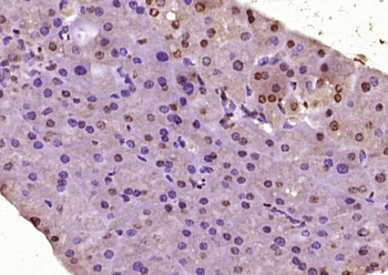 LIM kinase 2 Rabbit Polyclonal Antibody