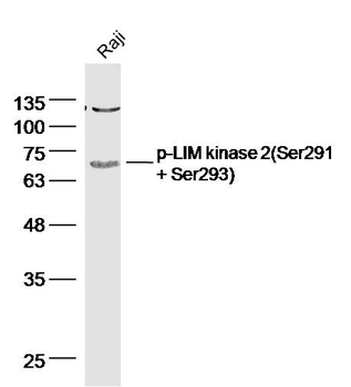 Phospho- LIM kinase 2 (Ser293) Rabbit Polyclonal Antibody