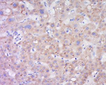 LIPC Rabbit Polyclonal Antibody