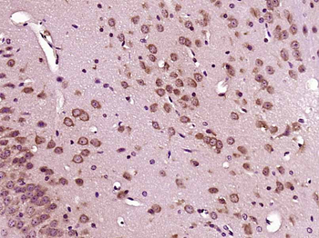 LIPT2 Rabbit Polyclonal Antibody