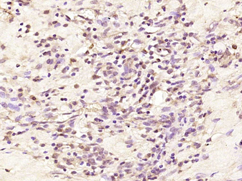 LOR/Loricrin Rabbit Polyclonal Antibody